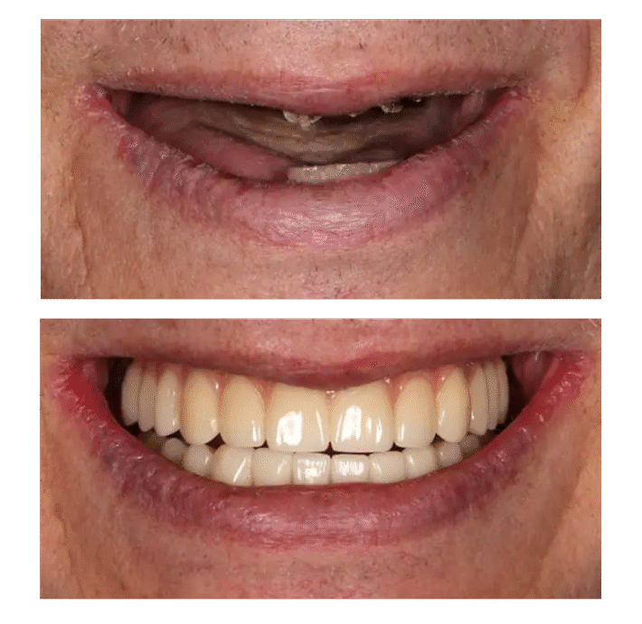 all on 4 vietnam 2 jaws