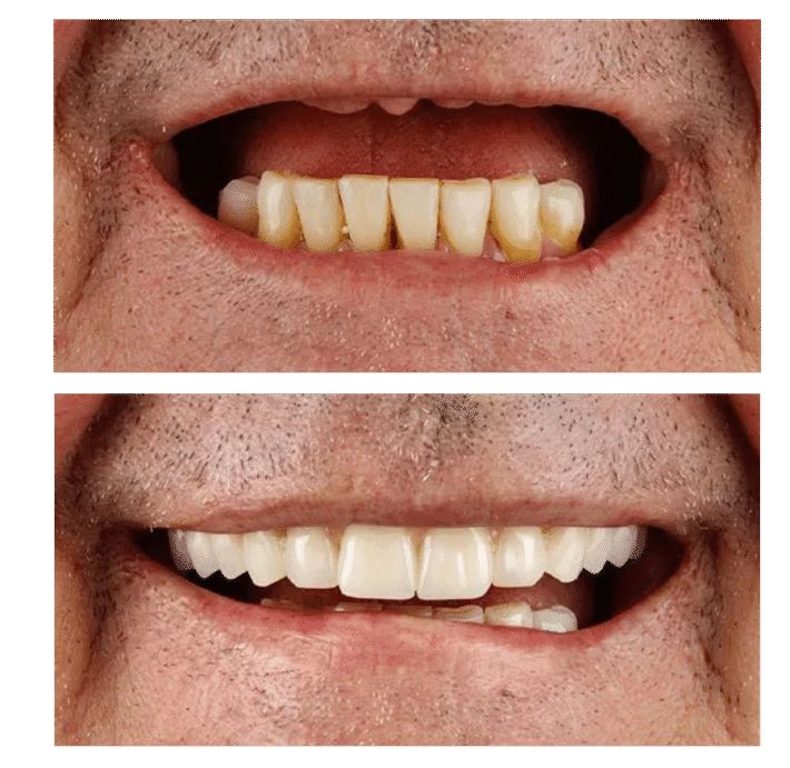 dental-surgery-in-vietnam