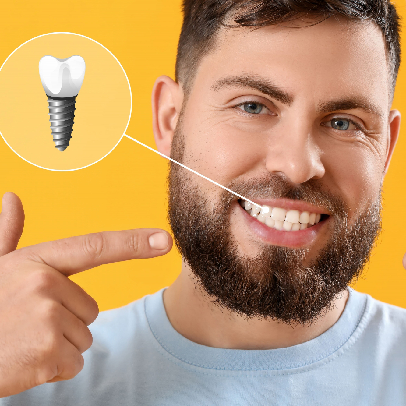 durable and long lasting dental implant